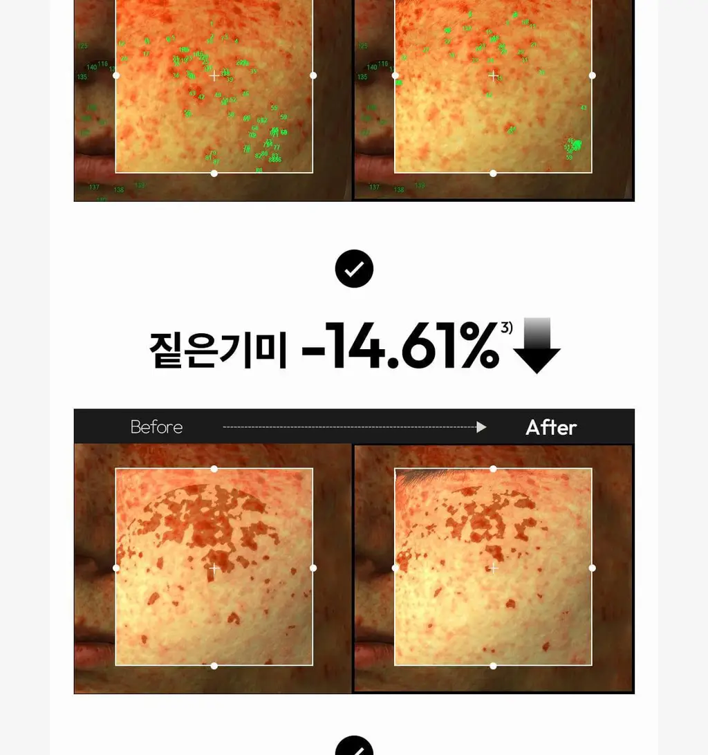 [기미잡티세럼] 레이어랩 기미흔적 클리어 세럼 30ml 상세페이지 20
